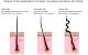 4a 4b 4c African American Hair Types