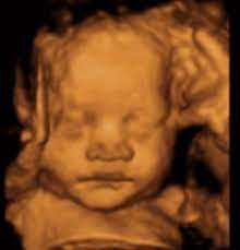 4d Ultrasound Houston Images Benefits Cost Locations Near Me