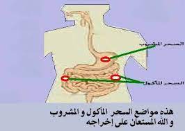 We did not find results for: Ø§Ù„Ø±Ù‚ÙŠØ© Ø§Ù„Ø´Ø±Ø¹ÙŠØ© Ù„Ù„Ù…Ø³ Ùˆ Ø§Ù„Ø¹ÙŠÙ† Ùˆ Ø§Ù„Ø³Ø­Ø± Ø§Ù„Ø¬Ø²Ø§Ø¦Ø± Ø­Ø§Ù„Ø§Øª Ø®Ø±ÙˆØ¬ Ø§Ù„Ù…ÙƒÙˆÙ†Ø§Øª Ø§Ù„Ø³Ø­Ø±ÙŠØ© Ù…Ù† Ø§Ù„Ø¬Ø³Ù… Ù…Ù„Ø§Ø­Ø¸Ø© Ù„Ø§ Ø¨Ø¯ Ø£Ù† Ù†Ø¹Ù„Ù… Ø£Ù† Ø§Ù„Ù…Ø³Ø§Ø¦Ù„ ÙˆØ§Ù„Ø£Ù…ÙˆØ± Ø§Ù„Ø­Ø³ÙŠØ© Ø§Ù„Ø®Ø§ØµØ© Ø¨Ø§Ù„Ø±Ù‚ÙŠØ© Ø§Ù„Ø´Ø±Ø¹ÙŠØ© ÙˆØ§Ù„Ù…ØªØ¹Ù„Ù‚Ø© Ø¨ØªØ£Ø«ÙŠØ±Ø§Øª Ø§Ù„Ø£Ù…Ø±Ø§Ø¶ Ø§Ù„Ø±ÙˆØ­ÙŠØ©