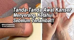 Apabila kanser usus dikesan pada peringkat awal, ia mungkin tidak mempunyai gejala. Pin On Brainfood