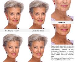 Bernard, but you're not ready for surgery? Face Lift Surgery Facelift Mid Face Lift Cheek Lift