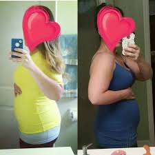 You the early symptoms of pregnancy may continue this week, and may become more noticeable. Super Bloated At 9 Weeks I Look 6 Months The Bump