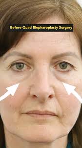 Centre For Facial Cosmetic & Plastic Surgery