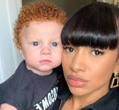 But if a person has a double mutation in this gene. Mixed Race Mum Says Strangers Ask If Her Son Was Swapped At Birth After He Was Born With Red Hair And Blue Eyes