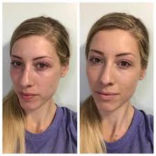 Tinted Moisturizer for Summer Makeup