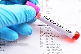 The test measures the number of hiv copies in a milliliter of blood. What Is Viral Load