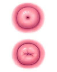 Does your cervix get hard when pregnant? Can Someone Get Pregnant If The Cervix Is Closed Quora