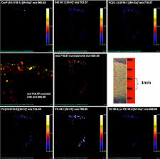 View pictures, images, and photos of medical conditions and diseases such as skin problems. Maldi Ms Images And Spectra From Normal Human Skin Acquired At A Download Scientific Diagram