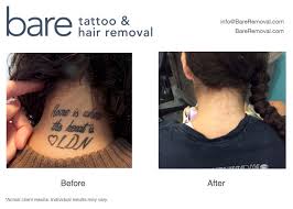 But no worry, the blister will heal anywhere between three and 14 days if cared for. Before After Bareremoval