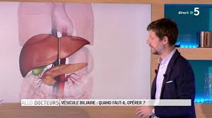 See more of allo docteur on facebook. Allo Docteurs Vesicule Biliaire Quand Faut Il Operer En Streaming Replay France 5 France Tv