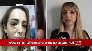 Goz Estetigi Ameliyati Bu Hale Getirdi Youtube