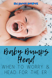Baby Bumps Head When To Worry Head For The Er Infographic Baby Bumped Head Baby Bumps Toddler Development