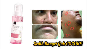Sedih Banget Liat Reaksi Kulit Gw pakai Scarlett Brightly Essence Toner