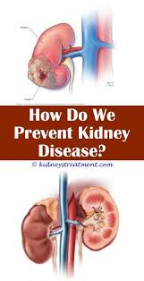 Kidney Cyst Essential Oils Kidney Disease Symptoms Polycystic Kidney Disease Kidney Disease