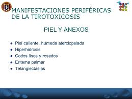 Plummer's disease is a form of toxic goiter that leads to hyperthyroidism. Hipertiroidismo Tirotoxicosis Es El Termino Que Se Utiliza Para Referirse A Las Alteraciones Bioquimicas Y Fisiologicas Que Resultan Cuando Los Tejidos Ppt Descargar