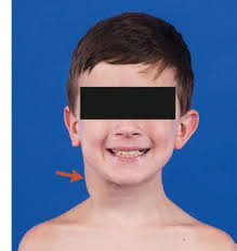 National Cancer Institute