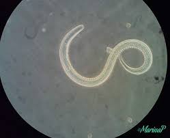 Image result for Hookworm