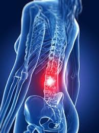 Another car crashed into the back of the car that keith was in. Back Injury Average Car Accident Settlement