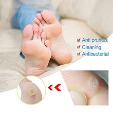 Warts, also known as common warts, are small bumps on your skin that are caused by a virus. Wart Remover Corn Remover Foot Corn Remover Pads Plantar Wart Removal Corn Callus Remover Penetrates And Removes Common And Plantar Warts Callus Stops Wart Regrowth Buy Online In United Arab Emirates At Desertcart Ae Productid 42153933