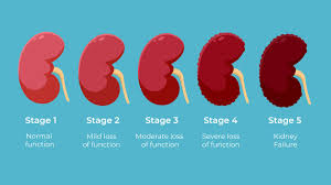 Image result for Renal Function