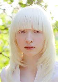 18 year old albino ukrainian model is known as the most beautiful angel and netizens are in awe with her unrivalled beauty albino model albino girl albinism