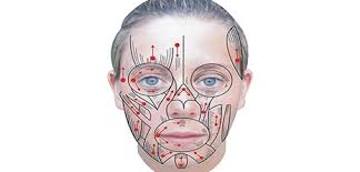 Yüz felci körlüğe sebep olabilir