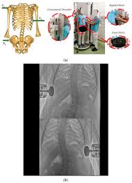 Image result for Fulcrum Test