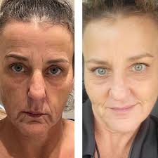 Skincare & Cosmetic Injections