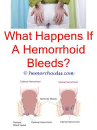 Pin On How Long Does It Take For Hemorrhoids To Heal