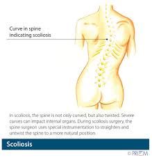 Related posts of human back bones diagram human bone parts name. Anatomy Library For Back Pain And Neck Pain Spinenevada Minimally Invasive Spine Institute