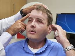 EXCLUSIVE: Mississippi man living like a 'normal dad' one year after  groundbreaking face transplant