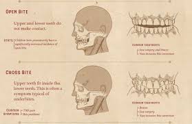 Biting The Inside Of Your Cheek Treatment Pin On Skin Disease