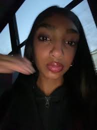 Did Emily Choppa Die