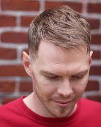 This condition is mainly experienced by men, but women also experience it where the front hairline begins thinning commonly on either sides of the forehead. 7 Receding Hairline Haircuts That Look Great Conceal Hair Loss