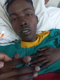 What is the diagnosis and management for a young boy with seizure and  shifted apex beat?