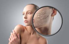 L'huile essentielle menthe poivrée haloma est 100% pure, naturelle et bio. Peau Deshydratee Et Huiles Vegetale Voici Mes Solutions Huiles Essentielles Aromatherapie Masque Visage Fait Maison Peau Deshydratee Peau Seche Visage