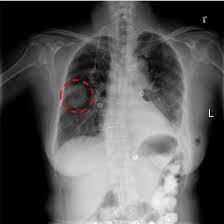 Other dogs have no symptoms at all. Changing Course Rethinking How Ai Can Interpret X Rays Technology Networks