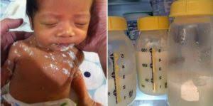 Setelah dipanaskan kemudian susu steril tersebut dimasukkan di dalam kemasan kaleng. 9 Cara Simpanan Susu Ibu Yang Berbahaya Untuk Bayi