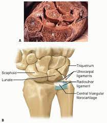 Triangular fibrocartilage complex (tfcc) injury. Arthroscopic And Open Triangular Fibrocartilage Complex Repair Musculoskeletal Key