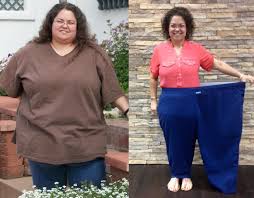 During the first month after gastric bypass surgery, most patients can expect to lose ~17% of their excess weight. Crystal S Gastric Sleeve Weight Loss Story Dfw Texas