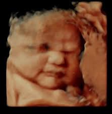 3D ultrasound and chubby babies! Post pics here