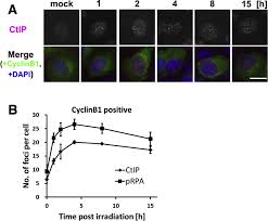 Digging deeper i found some educational sites that prefer foci and they explain it as an irregular noun with a. Novel Characteristics Of Ctip At Damage Induced Foci Following The Initiation Of Dna End Resection Sciencedirect