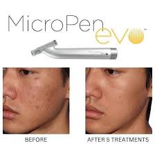 FLO Nails Aesthetics Laser (@flo_on_locke) · Hamilton, ON