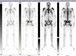 Pin On Musculoskeletal Radiology