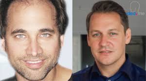 Digital Medicine Moonshots Solve Major World Health Challenges?