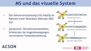 Ursachen für schwindel können zum beispiel auch blutdruckprobleme, angstzustände, schlaganfälle, migräne, degenerative gehirnerkrankungen, tumore, multiple sklerose oder die nebenwirkungen von medikamenten sein. Forschung Zur Ursache Von Ms Schweiz Ms Gesellschaft