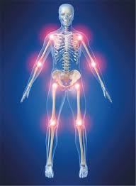 Da sich fibromyalgie bei betroffenen auf unterschiedliche weise äußert, gibt es auch kein allgemeinverbindliches rezept zur symptomlinderung. Rheuma Plus Fibromyalgie Komorbiditat Gibt Ratsel Auf