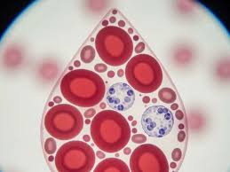 Image result for Heme