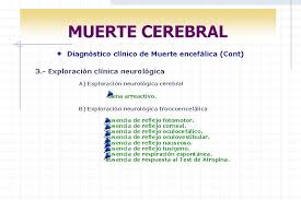 García ibarra aclara que, para diagnosticar muerte cerebral a un paciente, se debe haber descartado otras causas hay que descartar muy bien otras condiciones antes de dar el diagnóstico clínico Dilemas Al Final De La Vida Carlos A