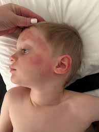 Just arrived last night at our Air bnb in PV. First time visitors My son  got eaten aliuve last night. What are these? Are they spiders? And what do  I ask for